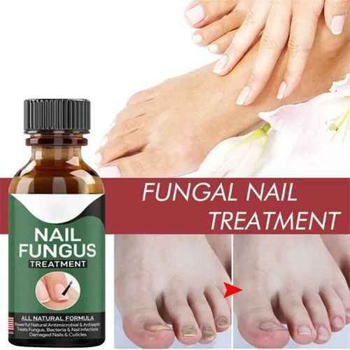 Fast Nail Fungal Treatment Gel - Nail Repair & Fungal Removal Serum - Image 3